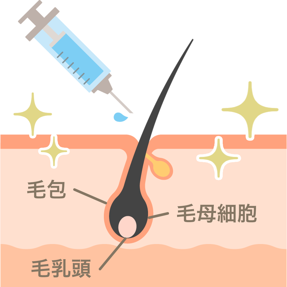 成長因子注入のイメージ