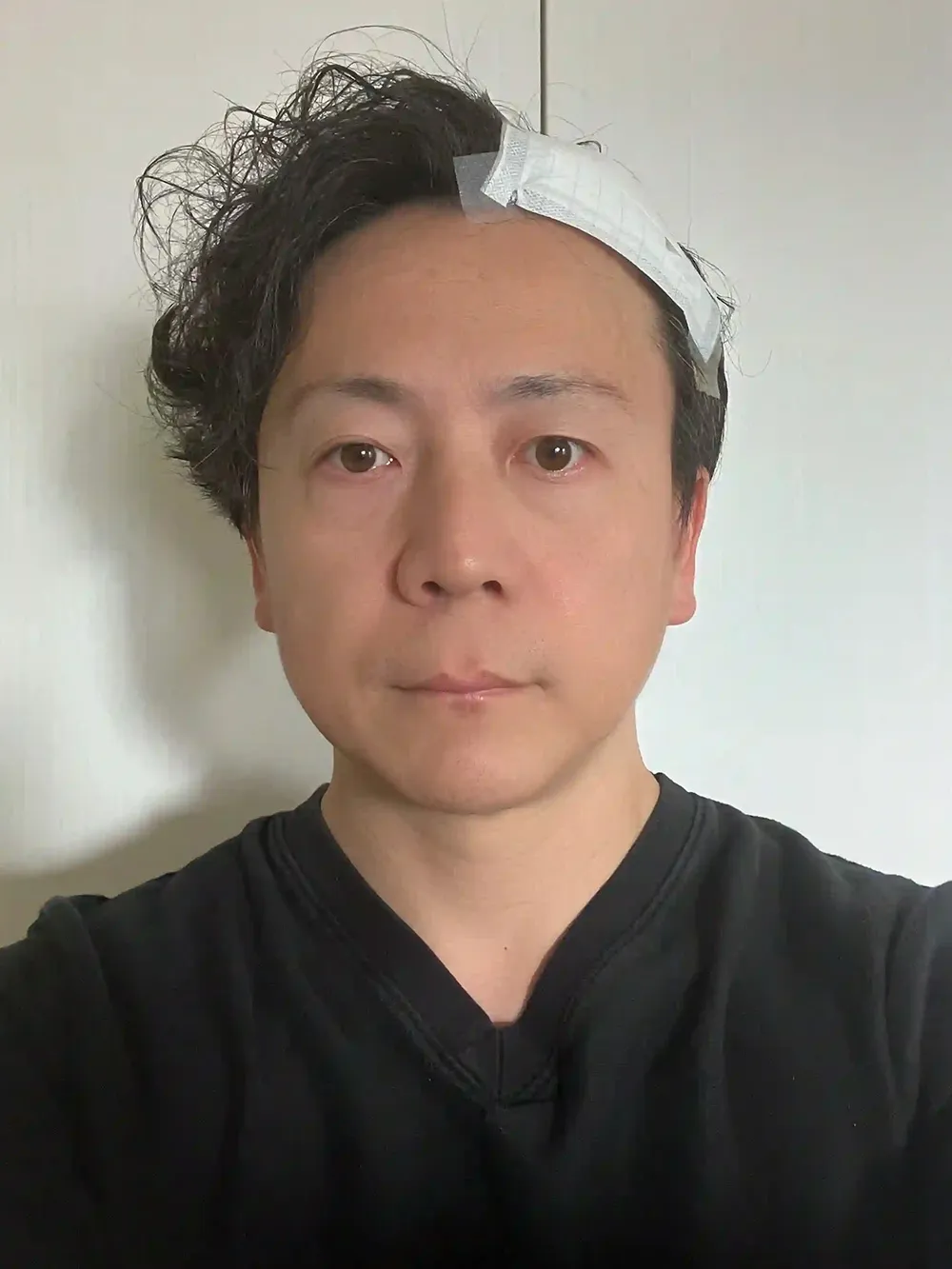 術後1日目の様子