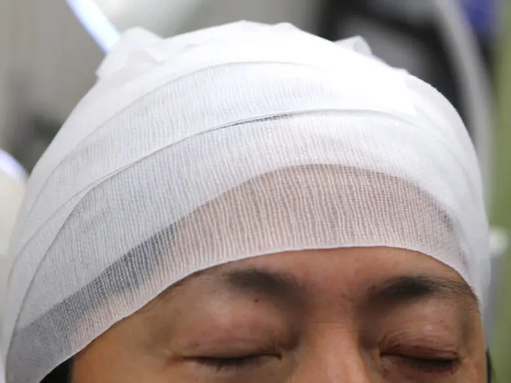 術後の様子