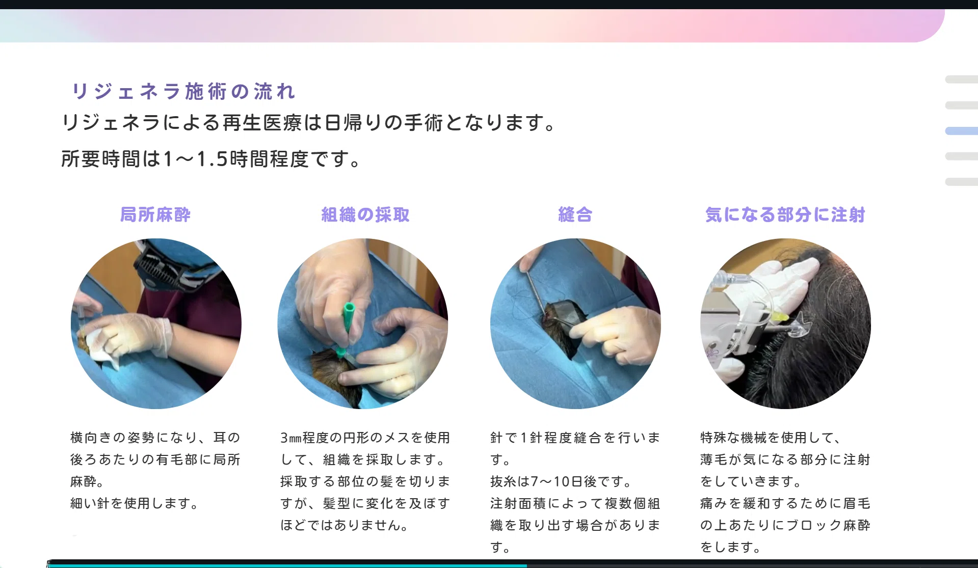 リジェネラ施術の流れ