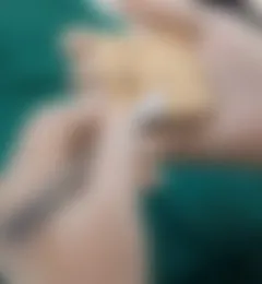 FUT法の様子