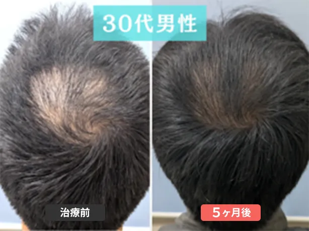 症例１　35歳　男性