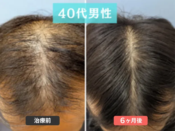 症例２　49歳　男性