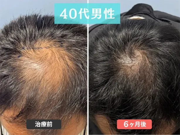 症例３　49歳　男性