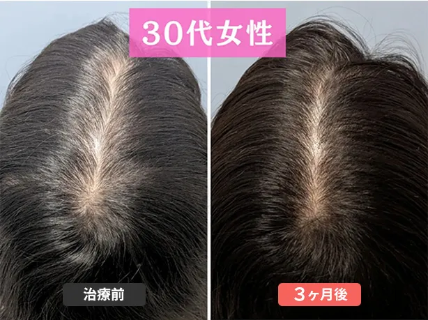 症例５　36歳　女性
