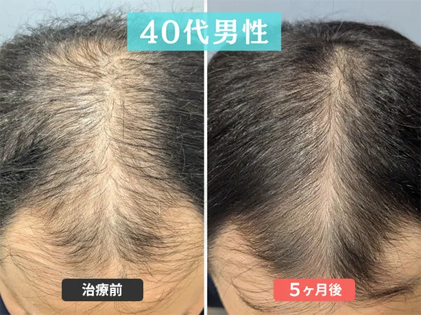 症例７　41歳　男性