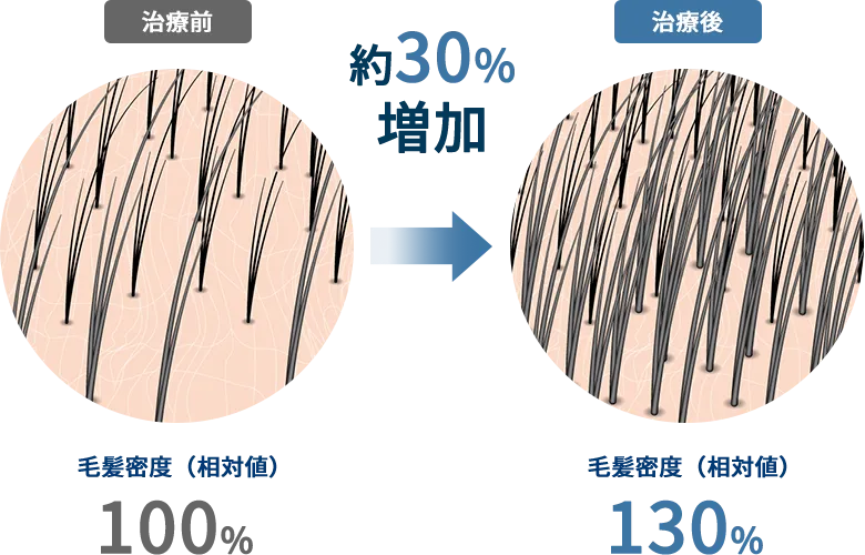 毛髪密度が約30%増加