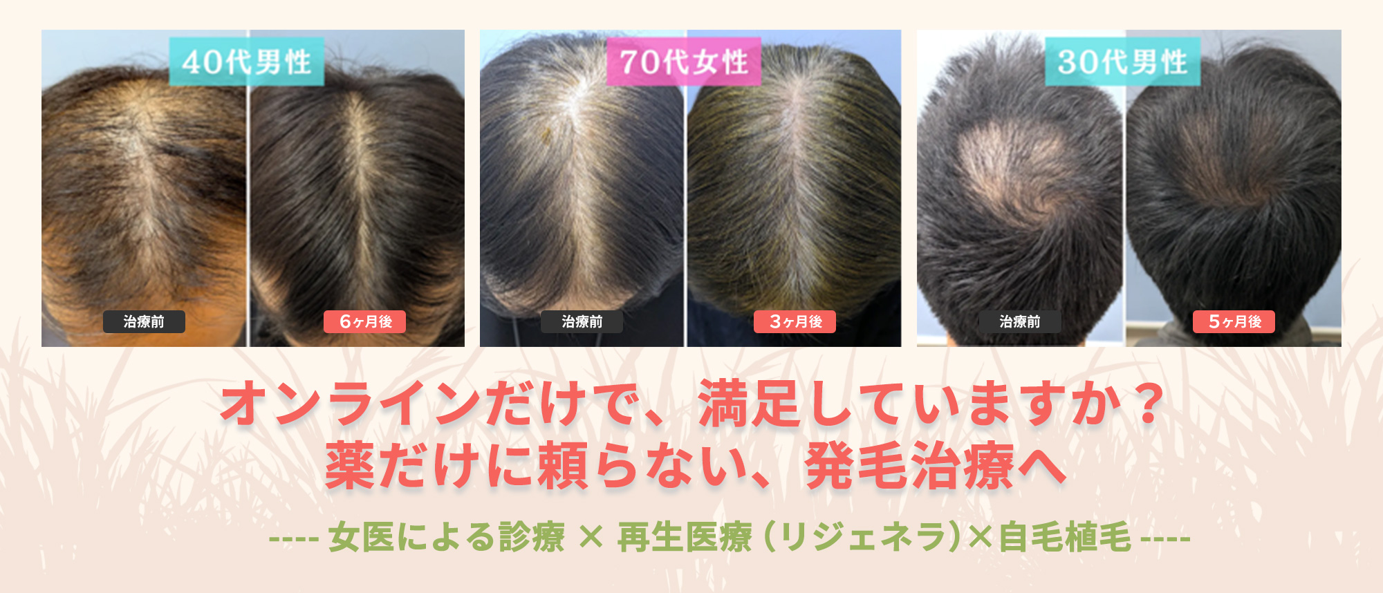 オンラインだけで、満足していますか？薬だけに頼らない、発毛治療へ
